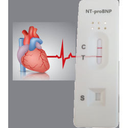 NT-proBNP - 15,10 zł (przy...